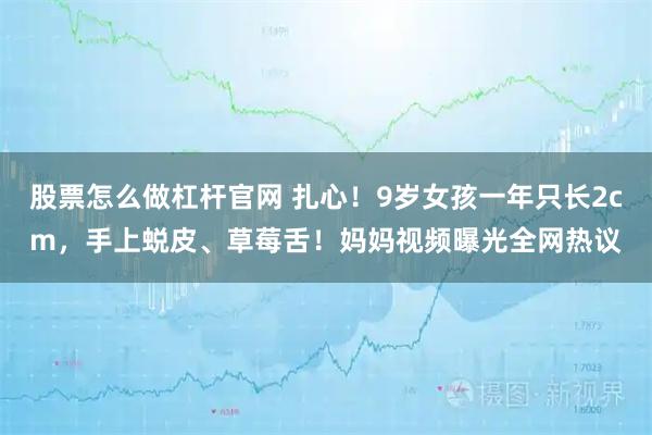 股票怎么做杠杆官网 扎心！9岁女孩一年只长2cm，手上蜕皮、草莓舌！妈妈视频曝光全网热议